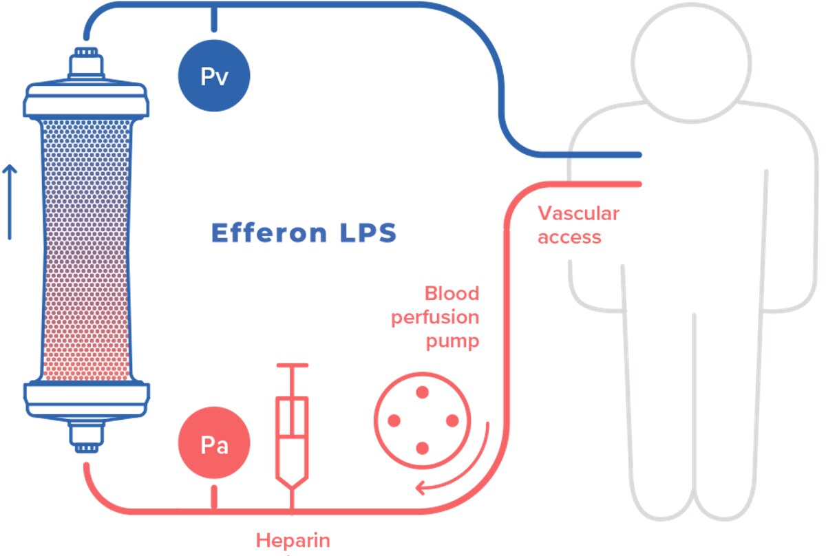Schematic of an Efferon LPS haemoperfusion circuit with blood pump, vascular access and heparin line