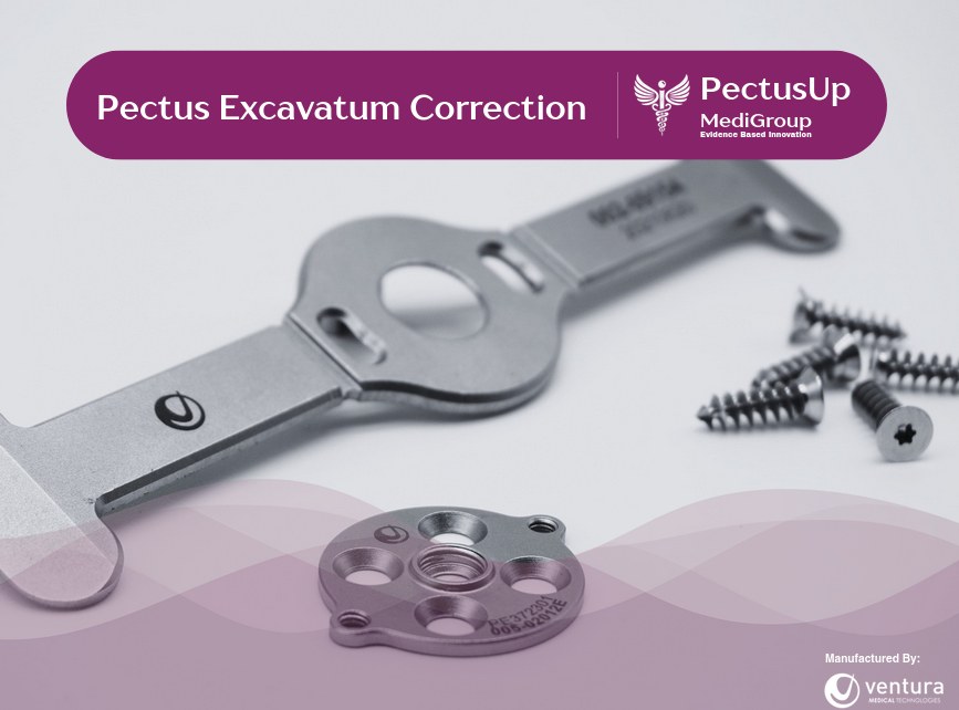 Pectus Up pectus excavatum correction kit with elevation plate, sternal plate and screws