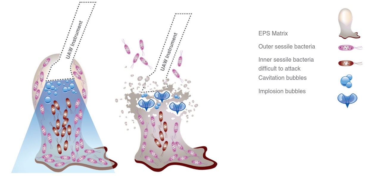 Diagram of biofilm disruption by ultrasound showing cavitation and implosion bubbles