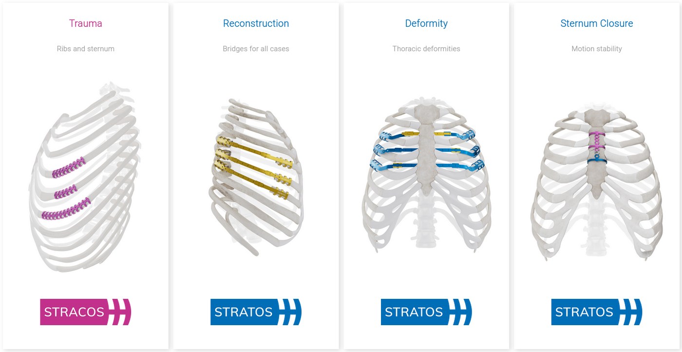 Four MedXpert indication diagrams: trauma, reconstruction, deformity and sternum closure